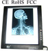 LED X-Ray film viewer x-ray illuminator viewing box LED negatoscope