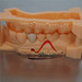 Dental Zirconia Crown from Mega Dental Lab