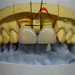 Dental Zirconia Crown from Mega Dental Lab
