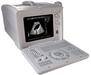 XF218 Protable Ultrasound Scanner