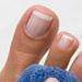 The Best Nail Fungus Treatment