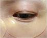 Hydro gel Eye patch