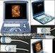 Ultrasound scanner Voluson E 4D real time year 2006