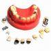Dental products, Zirconia, PFM, Inlay, FMC, Captet, Glod, Emax