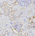 ATG16L1 polyclonal antibody