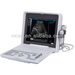 Portable Ultrasound machine Medical diagnostic