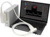 SmartUs - Digital High Performance Echo Color Doppler