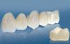 Dental porcelain teeth