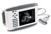 Hand-held Ultrasound Scanner RW802/802V