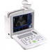 HY-160 Ultrasound Scanner