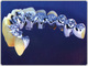 Shenzhen Xinhong False Tooth Devise Co., Ltd.: Regular Seller, Supplier of: crown bridge, porcelain, all ceramic, acrylic denture, co-cr denture, valplast denture, orthodontic, appliances, attachment. Buyer, Regular Buyer of: crown bridge, porcelain, all ceramic, acrylic denture, co-cr denture, valplast denture, orthodontic, appliances, attachment.